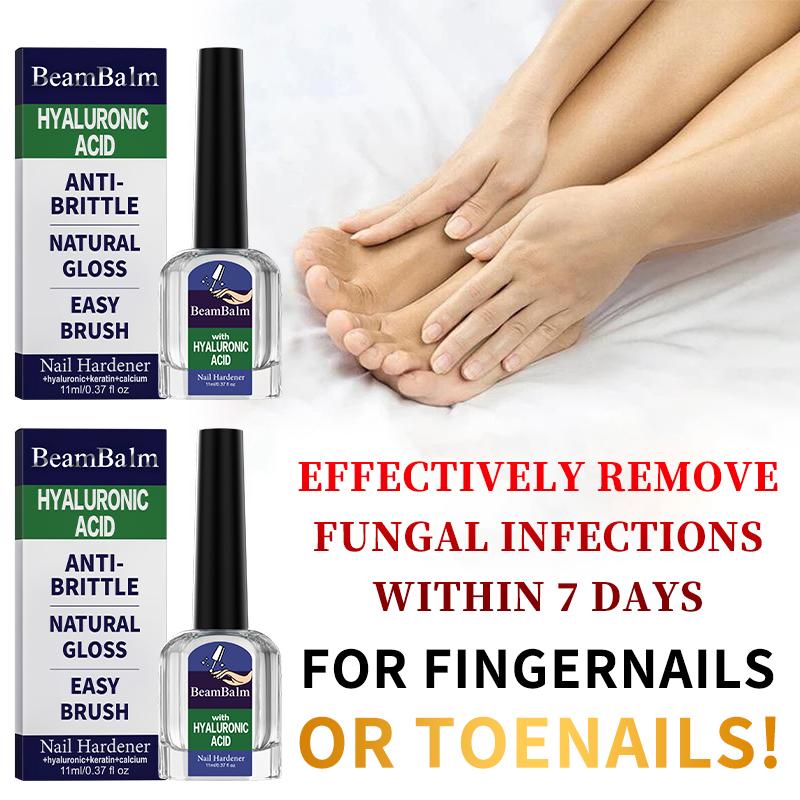 👣Powerful Nail Fungus Repair Serum💅| 3-in-1 Care Revives Bad Nails | Eliminates Fungi, Hardens Nails & Stimulates Natural Regrowth-TI