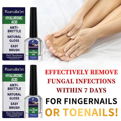 👣Powerful Nail Fungus Repair Serum💅| 3-in-1 Care Revives Bad Nails | Eliminates Fungi, Hardens Nails & Stimulates Natural Regrowth-TI