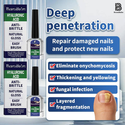 👣Powerful Nail Fungus Repair Serum💅| 3-in-1 Care Revives Bad Nails | Eliminates Fungi, Hardens Nails & Stimulates Natural Regrowth-TI