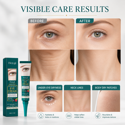 👁️Hoygi Collagen Berry Eye Cream, Anti Dark Circle Anti Aging Under Eye Treatment-TI